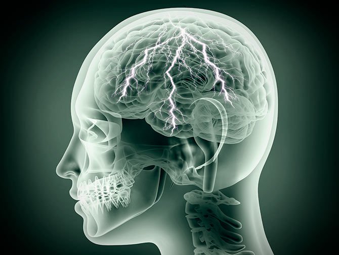 Dieta cetogénica y tumor cerebral