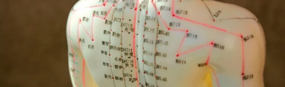 Tratamiento con acupuntura Barcelona