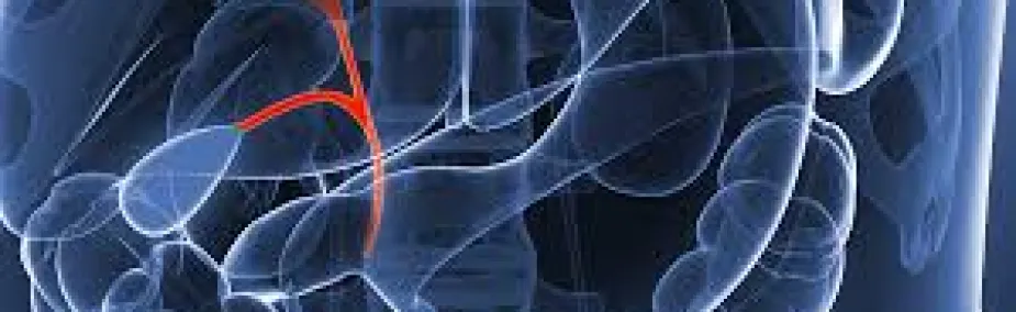 Tratamiento natural cáncer vías biliares