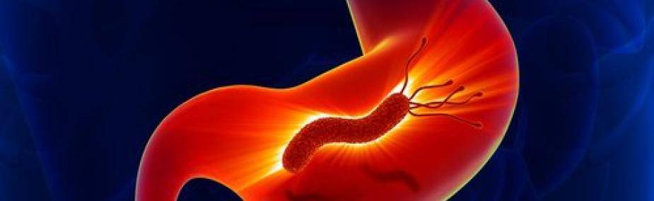 Helicobacter pylori tratamiento natural Tratamiento natural del Helicobacter Pylori