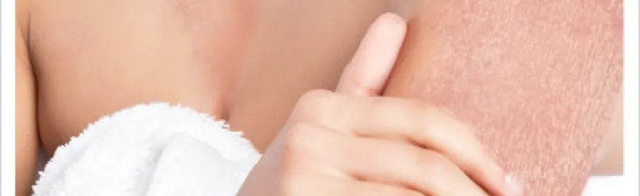 Tratamiento natural de la psoriasis